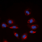 Anti-COL4A6 antibody used in Immunocytochemistry/ Immunofluorescence (ICC/IF). GTX56141