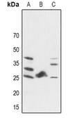 Anti-FGF19 antibody used in Western Blot (WB). GTX56182