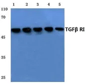 Anti-TGF beta Receptor I antibody used in Western Blot (WB). GTX57156