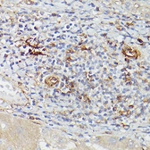 Anti-CD39 antibody used in IHC (Paraffin sections) (IHC-P). GTX57161