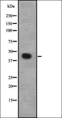 Anti-CACNG8 antibody used in Western Blot (WB). GTX57219