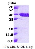 Human NFKBID protein, His tag. GTX57245-pro