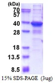 Human TGIF2LX protein, His tag. GTX57260-pro