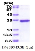 Human TGIF2LY protein, His tag. GTX57264-pro