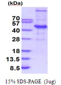 Human UBE2Q2 protein, His tag. GTX57279-pro