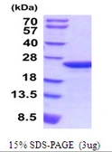 Mouse Myosin Light Chain 2 protein, His tag. GTX57284-pro