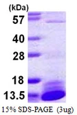 Human DYNLL2 protein, His tag. GTX57348-pro