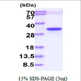 Human PHOSPHO1 protein, His tag. GTX57373-pro