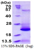Human BLOC1S2 protein, His tag. GTX57406-pro