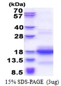 Human CNPY1 protein, His tag. GTX57410-pro