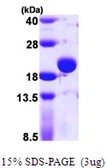 E. coli TPX protein, His tag. GTX57467-pro