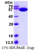 E. coli pykF protein, His tag. GTX57469-pro