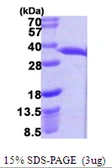 E. coli hchA protein, His tag. GTX57473-pro