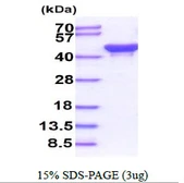 E. coli ackA protein, His tag. GTX57475-pro