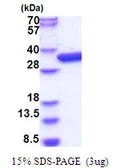 E. coli glk protein, His tag. GTX57476-pro