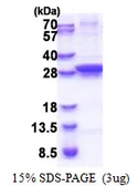 E. coli ung protein, His tag. GTX57480-pro