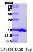 E. coli msrB protein, His tag. GTX57483-pro