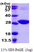 E. coli cysH protein, His tag. GTX57484-pro