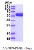 E. coli glpK protein, His tag. GTX57492-pro