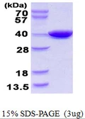 E. coli CoaA protein, His tag. GTX57494-pro