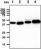 Anti-YKL-39 antibody [AT2B5] used in Western Blot (WB). GTX57710