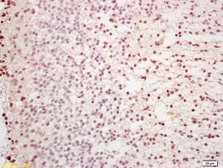 Anti-Capicua antibody used in IHC (Paraffin sections) (IHC-P). GTX60259