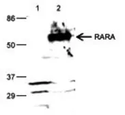 Anti-Retinoic Acid Receptor alpha antibody - ChIP grade used in Western Blot (WB). GTX60338