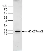 Anti-Histone H3K27me2 (Di-methyl Lys27) antibody - ChIP grade used in Western Blot (WB). GTX60351