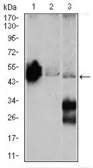 Anti-NSE antibody [5D3] used in Western Blot (WB). GTX60625