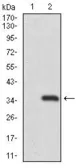 Anti-RAG1 antibody [1D9] used in Western Blot (WB). GTX60644