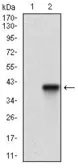 Anti-TRAP antibody [5C5E7] used in Western Blot (WB). GTX60778