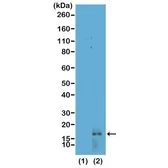 Anti-Histone H3K14me2 (Di-methyl Lys14) antibody [RM165] used in Western Blot (WB). GTX60891