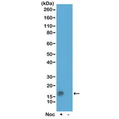 Anti-Histone H3T11ph (phospho Thr11) antibody [RM164] used in Western Blot (WB). GTX60898