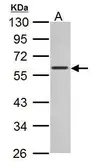 Anti-c-Myc antibody [GT168] used in Western Blot (WB). GTX628459