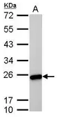 Anti-Transgelin antibody [GT336] used in Western Blot (WB). GTX628831