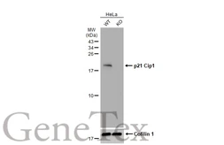 Anti-p21 Cip1 antibody [GT1032] used in Western Blot (WB). GTX629543