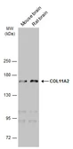 Anti-COL11A2 antibody [GT473] used in Western Blot (WB). GTX629740