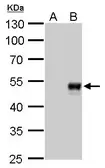 Anti-BMP8b antibody [GT1017] used in Western Blot (WB). GTX629764