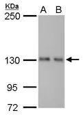 Anti-ARHGEF18 antibody [GT1972] used in Western Blot (WB). GTX629806