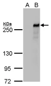 Anti-TET2 antibody [GT411] used in Western Blot (WB). GTX629879