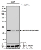 Anti-Fumarate hydratase antibody [GT7612] used in Western Blot (WB). GTX630146