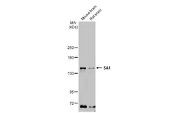 Anti-SA1 antibody [GT1515] used in Western Blot (WB). GTX632010