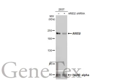 Anti-ARID2 antibody [GT7311] used in Western Blot (WB). GTX632011