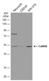 Anti-CaMKII antibody [GT4811] used in Western Blot (WB). GTX632127