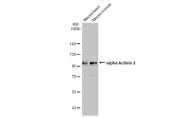 用于Western Blot（WB）的抗α-肌动蛋白2抗体[GT1253]。GTX632361型