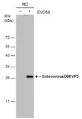 Anti-Enterovirus D68 VP3 antibody [GT1665] used in Western Blot (WB). GTX633706