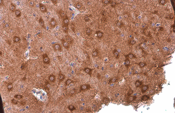 Anti-PYK2 antibody [GT858] used in IHC (Paraffin sections) (IHC-P). GTX634162