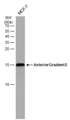Anti-Anterior Gradient 2 antibody [GT5812] used in Western Blot (WB). GTX634163