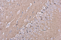 Anti-NCAM antibody [GT135] used in IHC (Paraffin sections) (IHC-P). GTX634792