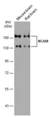 Anti-NCAM antibody [GT249] used in Western Blot (WB). GTX634807